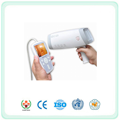 SY9801 Handheld Electronic Colposcopy